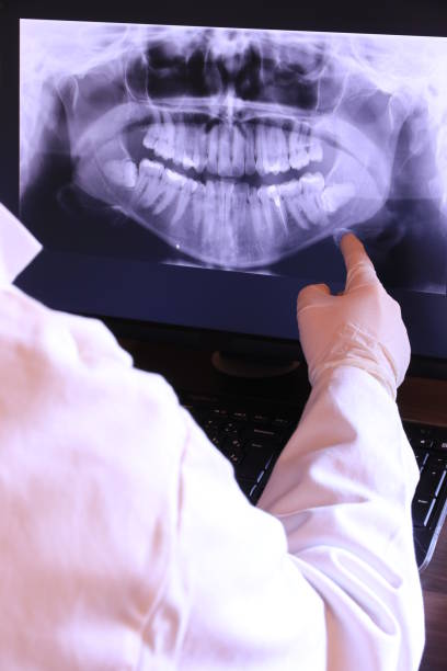 Best Emergency Wisdom Tooth Extraction in Level Green, PA