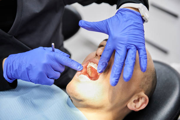 Best Emergency Dental Care for Sports Injuries in Level Green, PA